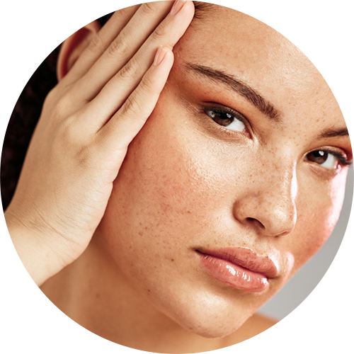 Dark Spots / Uneven Skin Tone