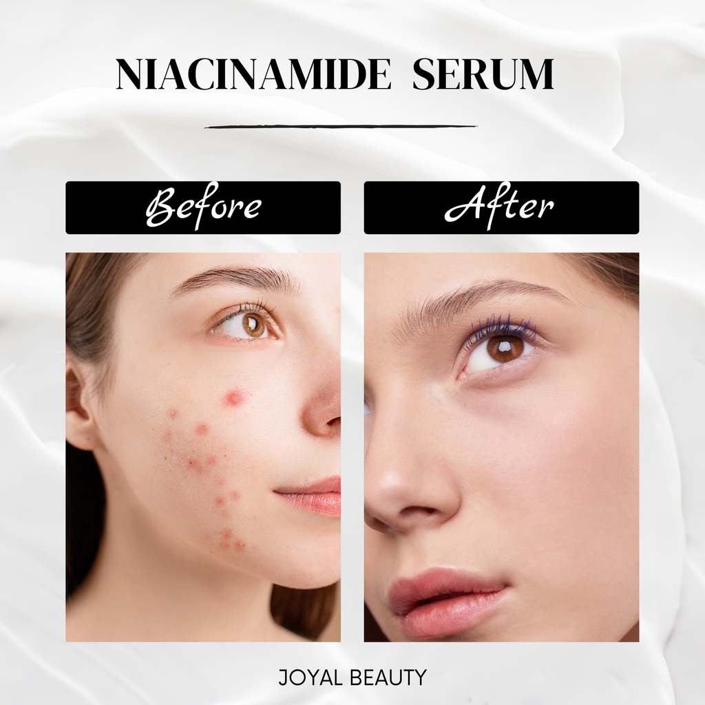 Niacinamide 5% (Vitamin B3) B5 Hydrating Gel with Hyaluronic Acid